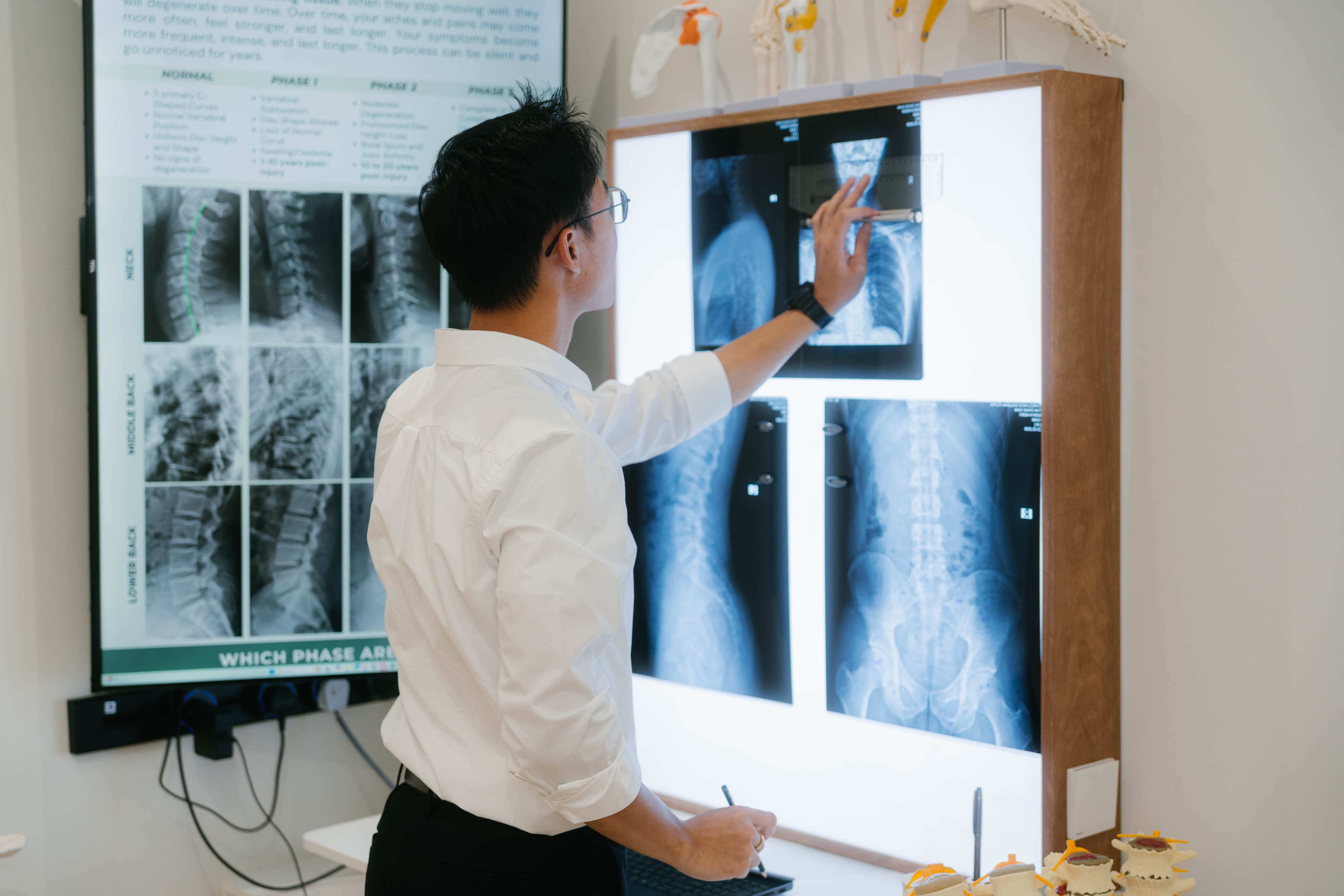 Why You Keep Getting Headaches And What Your Spine Has to Do With It
