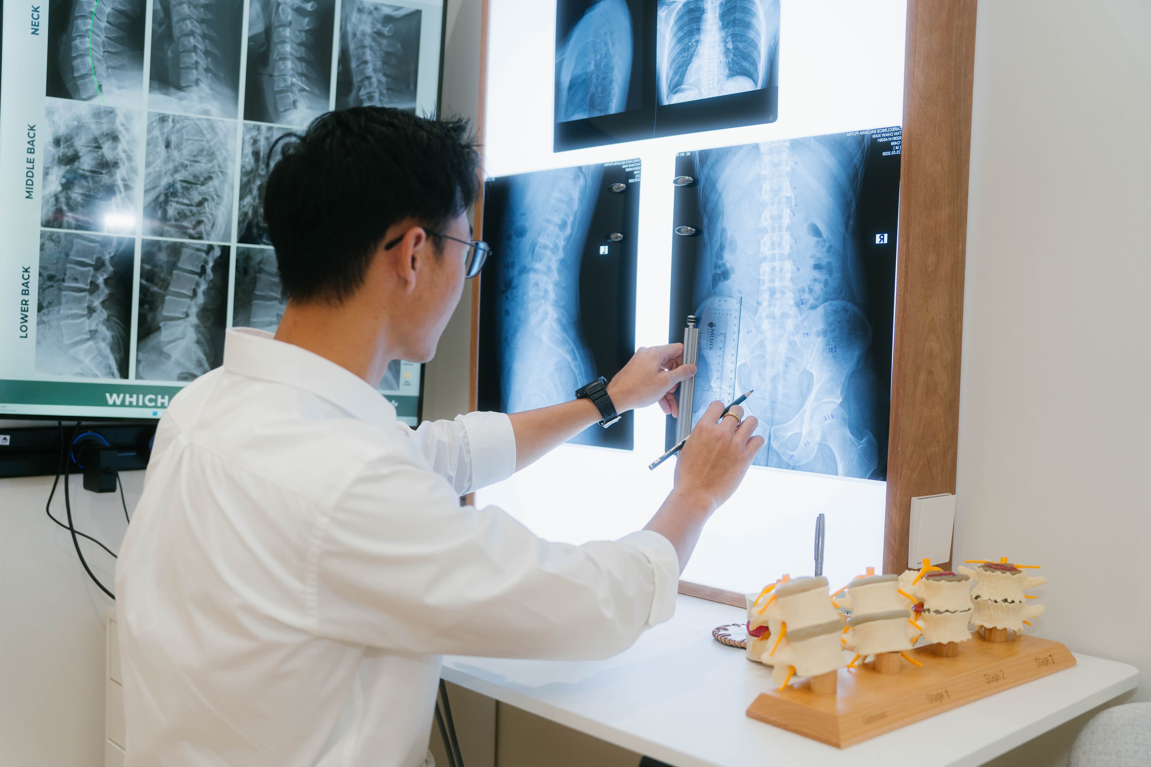 Slipped Disc and Chiropractic Care: Why the Right Assessment Changes Everything